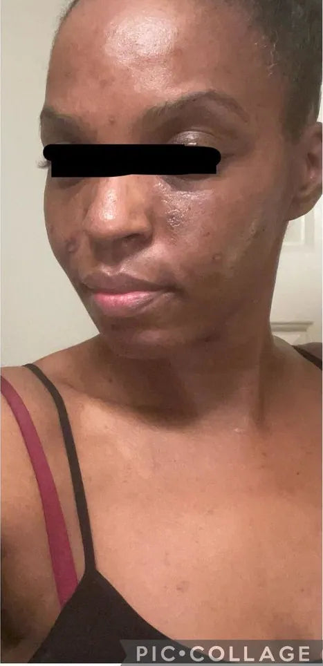 After: photo shared by N.R. in her review of Luxe XL Bundle