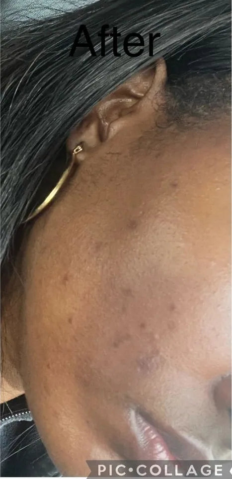 After: photo shared by Tina J. in her review of COTA Bundle