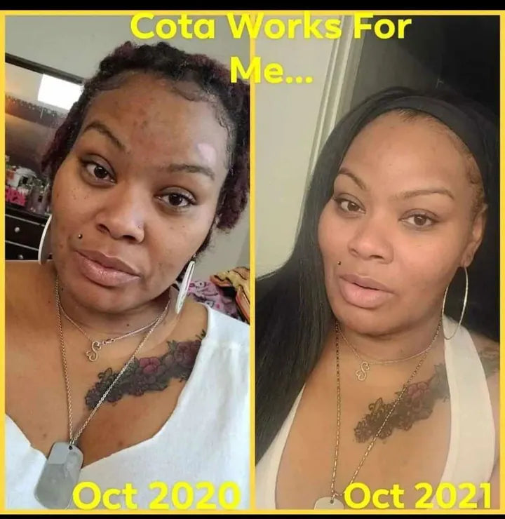 October 2020 to October 2021: photo shared by Taniqua C. in her review of COTA Deluxe